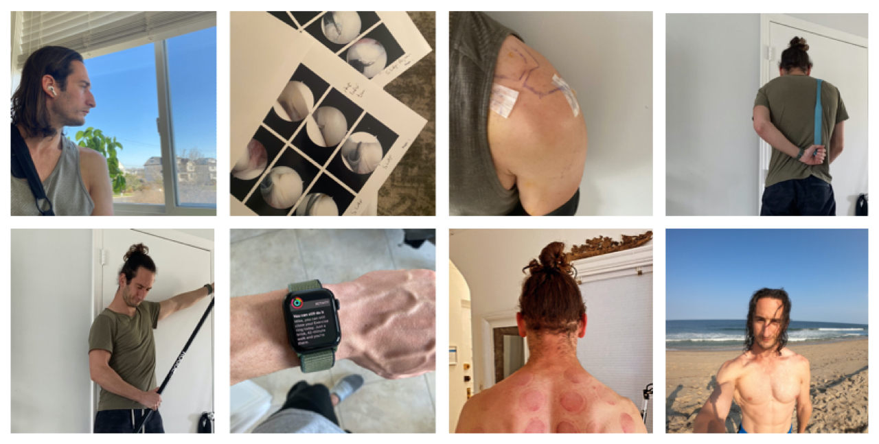 How I Came Back From Shoulder Surgery — Twice!